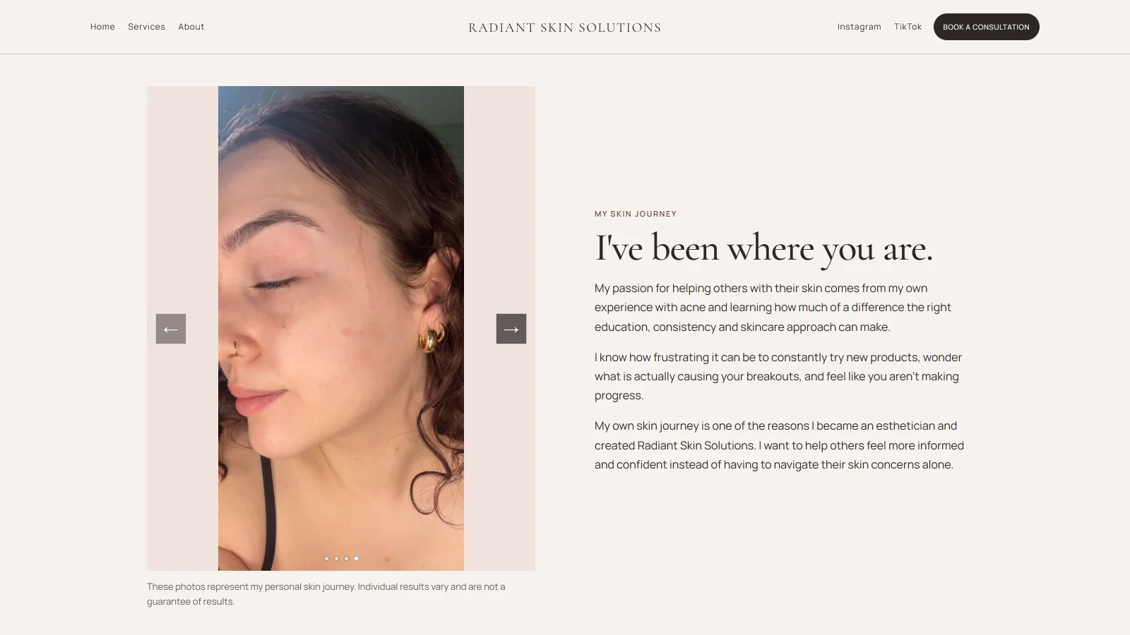 My Skin Journey